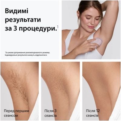 Фотоепілятор Braun PL1111 + GIL Venus PL1111 + GIL Venus фото